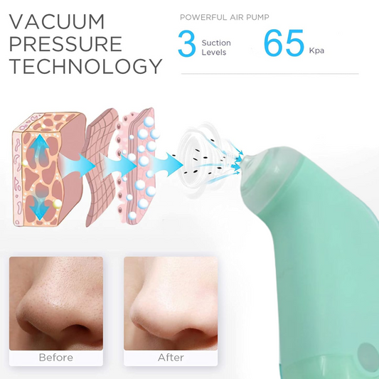 Vacuum Blackhead Remover Machine – Mini Handheld Facial Pore Cleaner & Lifting Massage Device for Deep Skin Care, Oil Control & Smooth Skin (1 Pc)